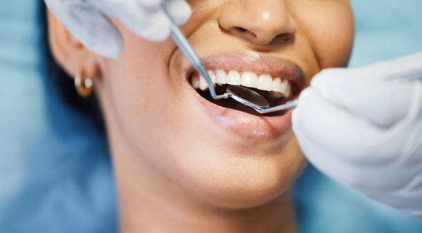 Best Walk-In Emergency Dentist in Bay Harbor Islands, FL